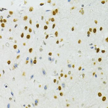 Immunohistochemistry - BRCA1 Polyclonal Antibody (144-11549)