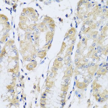 Immunohistochemistry - FANCA Polyclonal Antibody (144-07671)