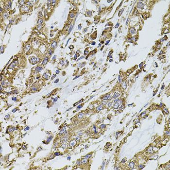 Immunohistochemistry - PIK3CA Polyclonal Antibody (144-00265)