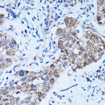 Immunohistochemistry - Caspase3 Polyclonal Antibody (144-60067)