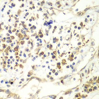 Immunohistochemistry - UPF1 antibody (144-013541)