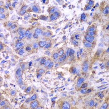 Immunohistochemistry - SDHA Polyclonal Antibody (144-02594)