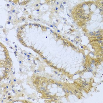 Immunohistochemistry - ACP1 antibody (144-012390)