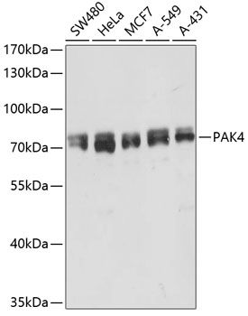 Western blot