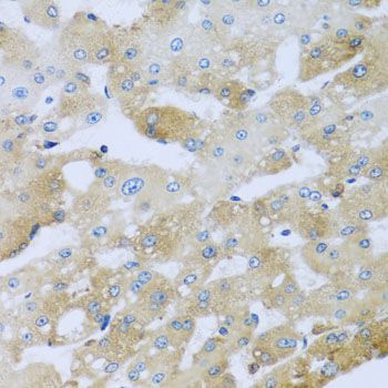 Immunohistochemistry - AP1M2 antibody (144-08331)