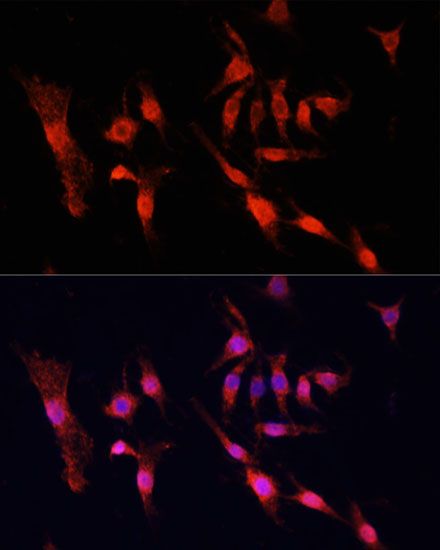 Immunofluorescence - EGFR Polyclonal Antibody (144-011577)