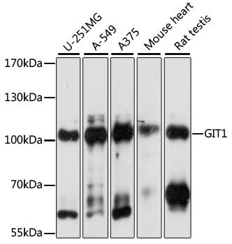 Western blot - [KO Validated] GIT1 Polyclonal Antibody (144-61053)