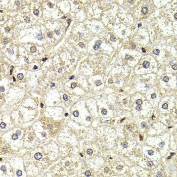 Immunohistochemistry - LMNB2 Polyclonal Antibody (144-06483)