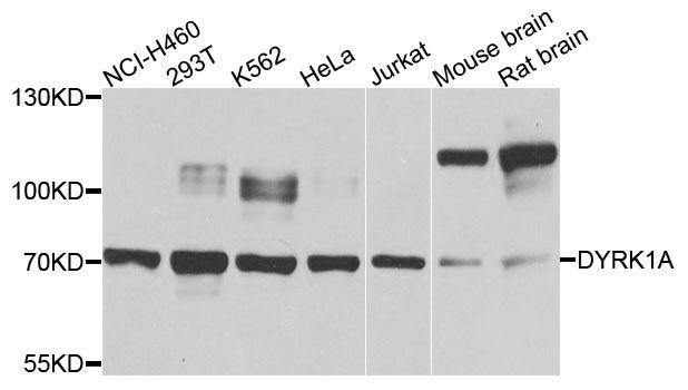 Western blot - DYRK1A Polyclonal Antibody (144-00595)