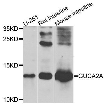 Western blot - GUCA2A antibody (144-09820)