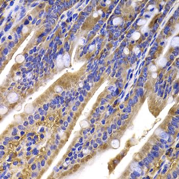 Immunohistochemistry - HDGFRP2 antibody (144-07484)
