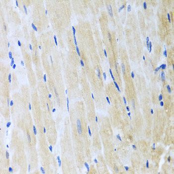 Immunohistochemistry - ITPKB antibody (144-03929)