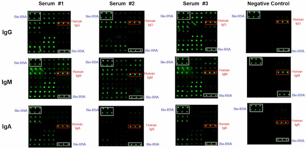 Monkeypox virus protein array glass slide result images of 3 patients and a negative control