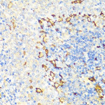 Immunohistochemistry - NAMPT Polyclonal Antibody (144-00256)