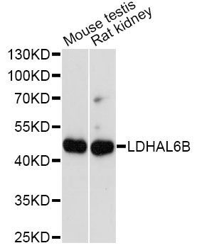Western blot - LDHAL6B antibody (144-014950)