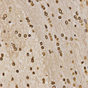 Immunohistochemistry - MonoMethyl-Histone H3-K27 antibody (144-02361)