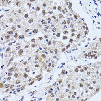 Immunohistochemistry - TP53BP1 antibody (144-05757)