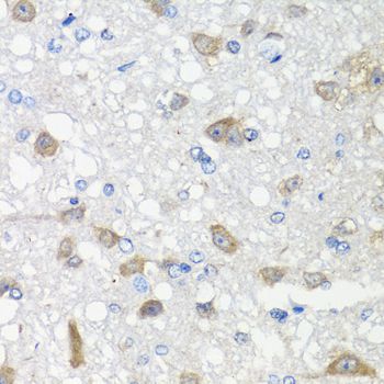 Immunohistochemistry - ACVR1C Polyclonal Antibody (144-00678)