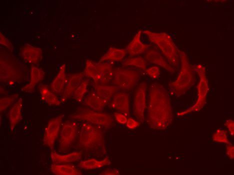 Immunofluorescence - TRPV5 antibody (144-06473)