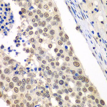 Immunohistochemistry - HDAC2 Polyclonal Antibody (144-02084)