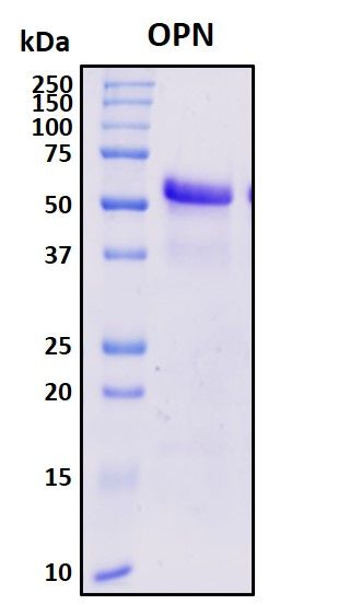 SDS-PAGE