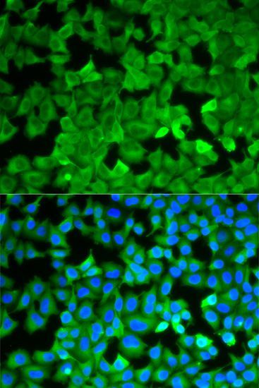 Immunofluorescence - ASNS antibody (144-05558)