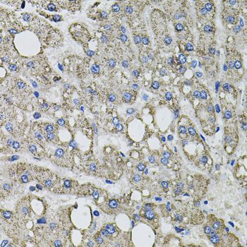 Immunohistochemistry - GFPT1 antibody (144-03882)