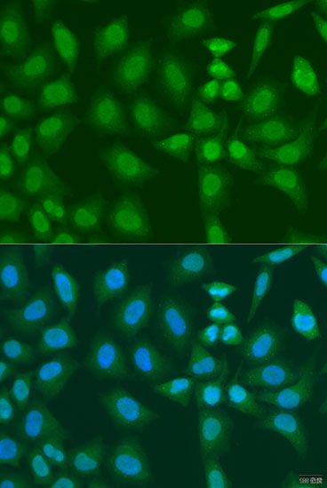 Immunofluorescence - PHF21B antibody (144-07849)