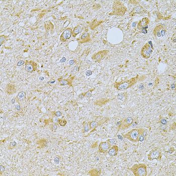 Immunohistochemistry - CAMK1G Antibody (144-07379)