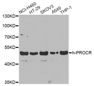 Western blot - PROCR antibody (144-60426)