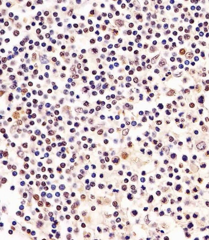 IHC-P