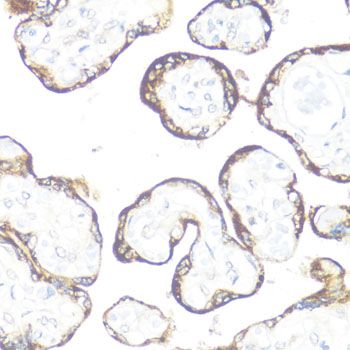 Immunohistochemistry - FGFR2 antibody (144-02074)