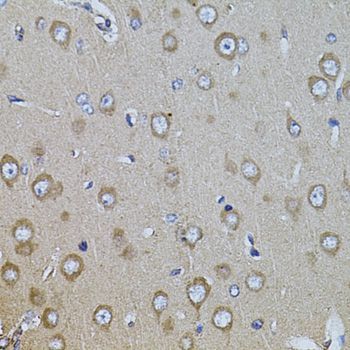 Immunohistochemistry - ITGB8 antibody (144-08433)