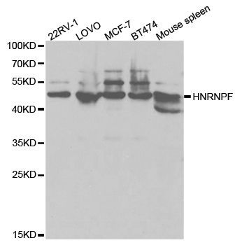 Western blot - HNRNPF Polyclonal Antibody (144-61419)