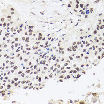 Immunohistochemistry - RPP30 antibody (144-08479)