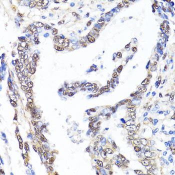 Immunohistochemistry - [KO Validated] YAP1 Polyclonal Antibody (144-01002)