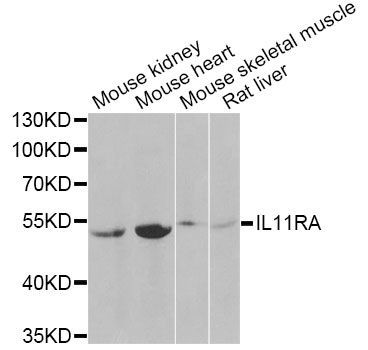 Western blot - IL11RA Antibody (144-06627)