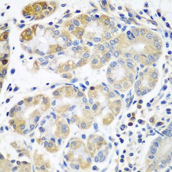 Immunohistochemistry - PLS3 Polyclonal Antibody (144-03627)