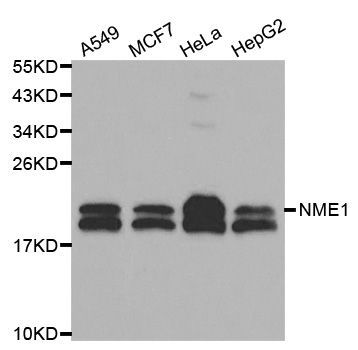 Western blot - NME1 Polyclonal Antibody (144-00259)