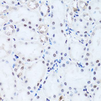Immunohistochemistry - HIST2H2BE antibody (144-01958)