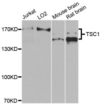 Western blot - TSC1 Polyclonal Antibody (144-00720)