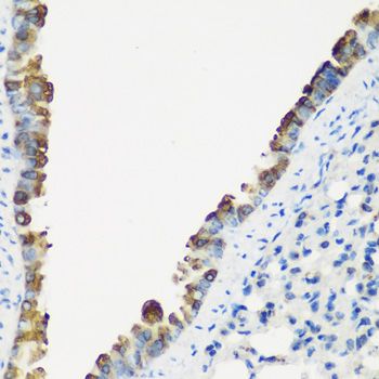 Immunohistochemistry - TNNC2 antibody (144-07740)
