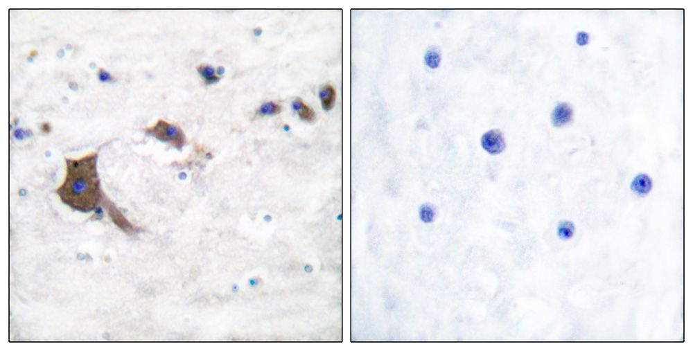 IHC