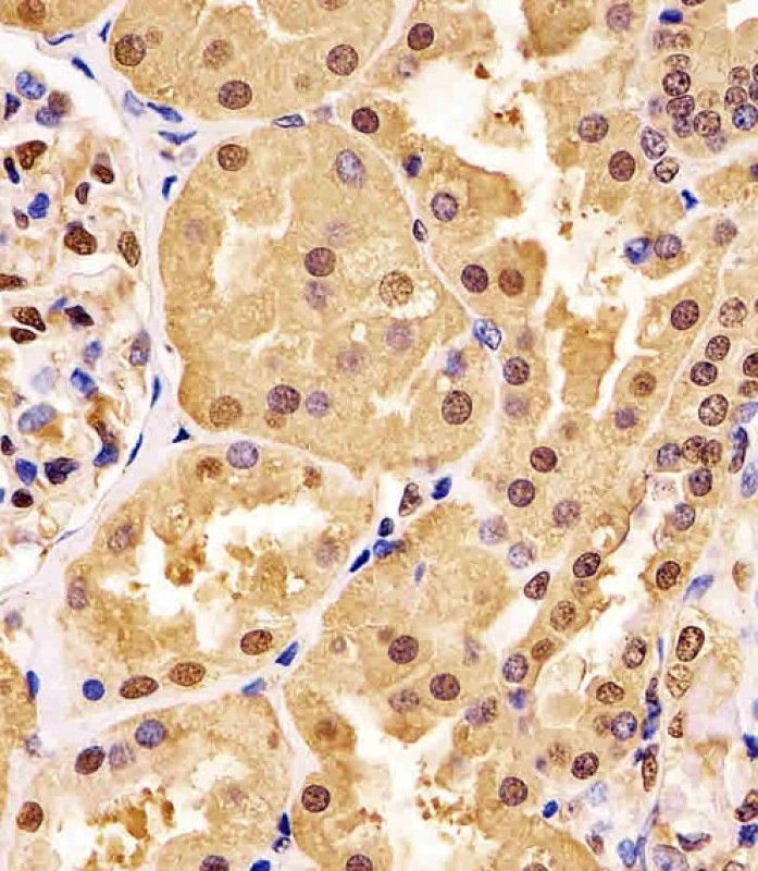 IHC-P