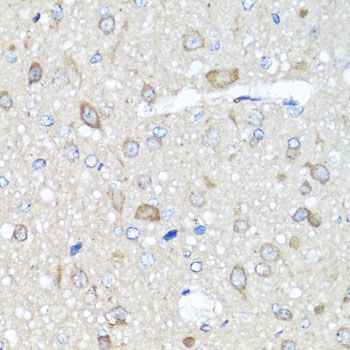 Immunohistochemistry - PRKAG1 antibody (144-07300)