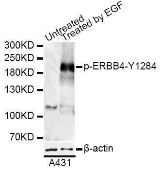 Western blot - Phospho-ERBB4-Y1284 antibody (144-50034)