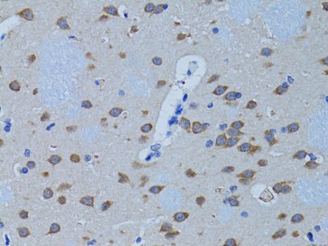 Immunohistochemistry - PLCB1 antibody (144-01971)
