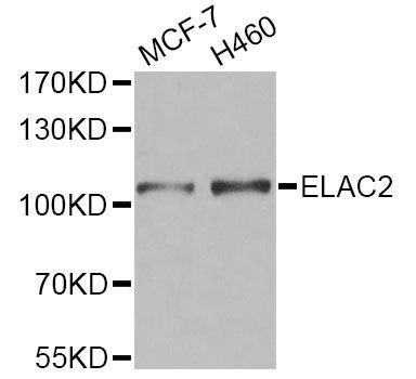 Western blot - ELAC2 Polyclonal Antibody (144-07128)