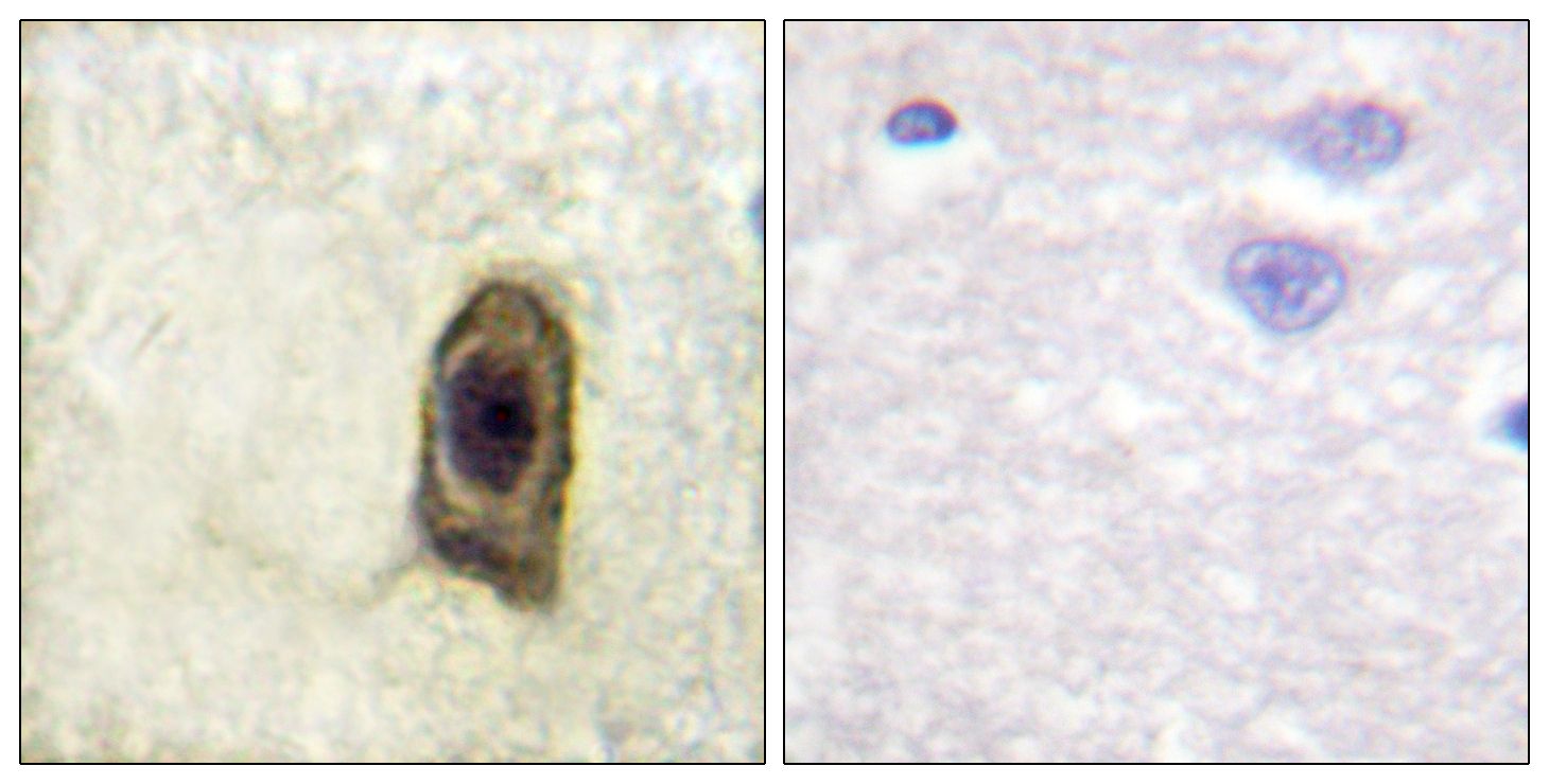 IHC