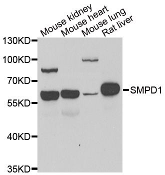 Western blot - SMPD1 antibody (144-06743)